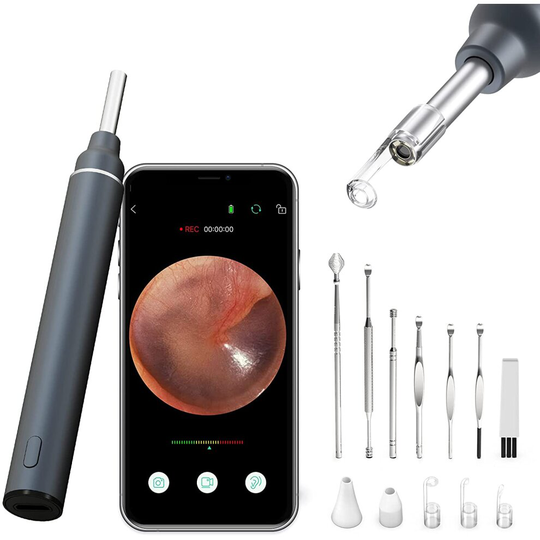 VITCOCO Otoscope Ear Camera 3.0mm Ultra-Thin Otoscope with 5MP HD Ear Wax Removal Kit Portable Visual Otoscope, Earwax Remover Set Gray